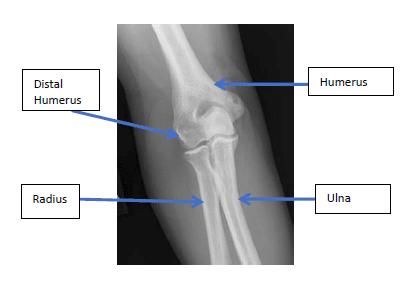 radius and ulna and humerus